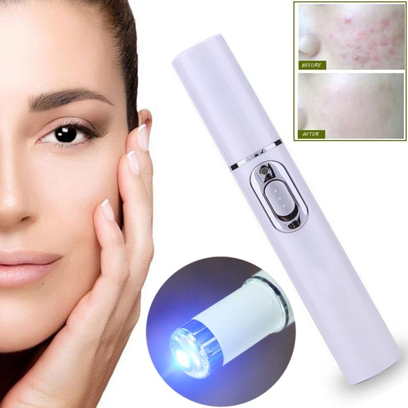 Acne Laser Pen